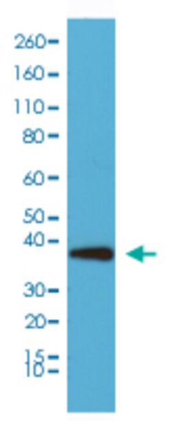 SYP Rabbit anti-Human, Clone: RM258, Abnova 100uL:Antibodies, Monoclonal