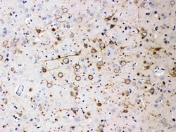 NF200, Mouse, Clone: NF-200, Abnova 100&mu;g; Unlabeled:Antibodies, Monoclonal