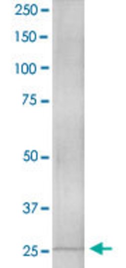 Hmox1 Mouse anti-Mouse, Rat, Clone:6B8-2F2, Abnova 100 &mu;g | Buy Online | Abnova | Fisher Scientific