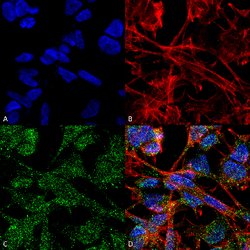 Slc12a5 Mouse anti-Human, Rat, HRP, Clone:S1-12, Abnova 100&mu;g:Antibodies,