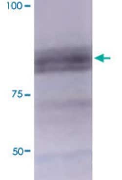 Mmp9 Mouse anti-Mouse, Rat, FITC, Clone:S51-82, Abnova 100&mu;g:Antibodies,