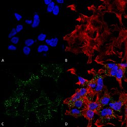 Slc17a8 Mouse anti-Human, Rat, HRP, Clone:S34-34, Abnova 100 &mu;g | Buy Online | Abnova | Fisher Scientific