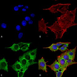 SLC1A1 Mouse anti-Human, Rat, Biotin, Clone:S180-41, Abnova 100&mu;g:Antibodies,