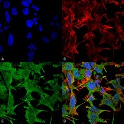 Nrcam Mouse anti-Human, Mouse, Rat, APC, Clone:S364-51, Abnova 100 &mu;g | Buy Online | Abnova Corporation | Fisher Scientific
