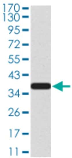 CBX2 Mouse anti-Human, Mouse, Clone:4C11B10, Abnova 100&mu;g:Antibodies,