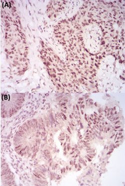 CBX2 Mouse anti-Human, Mouse, Clone:4C11B10, Abnova 100&mu;g:Antibodies,