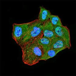 CBX2 Mouse anti-Human, Mouse, Clone:4C11B10, Abnova 100&mu;g:Antibodies,