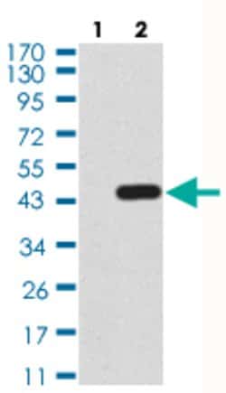 NTRK2 Mouse anti-Human, Clone:10B6C4, Abnova 100&mu;g:Antibodies, Monoclonal