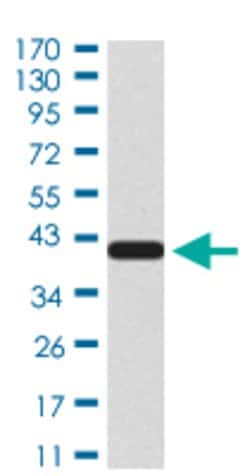 NTRK2 Mouse anti-Human, Clone:10B6C4, Abnova 100&mu;g:Antibodies, Monoclonal