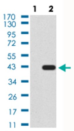 SIRT6 Mouse anti-Human, Clone:2G1E8, Abnova 100&mu;g:Antibodies, Monoclonal
