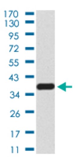 SIRT6 Mouse anti-Human, Clone:2G1E8, Abnova 100&mu;g:Antibodies, Monoclonal