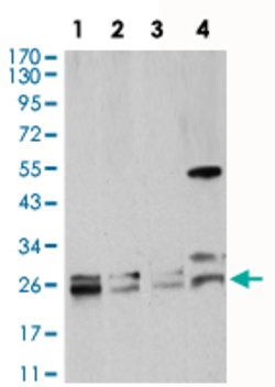 RAB5A Mouse anti-Human, Clone:2E8B11, Abnova 100&mu;g:Antibodies, Monoclonal