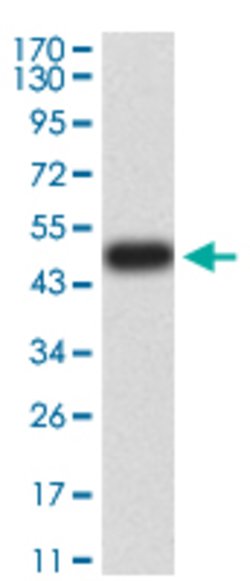 RAB5A Mouse anti-Human, Clone:2E8B11, Abnova 100&mu;g:Antibodies, Monoclonal