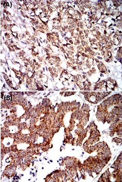 PTPN14 Mouse anti-Human, Clone:2B3H7, Abnova 100&mu;g:Antibodies, Monoclonal