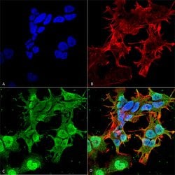 Cacng2/Cacng4/Cacng8 Mouse anti-Rat, APC, Clone:S245-36, Abnova 100&mu;g:Antibodies,