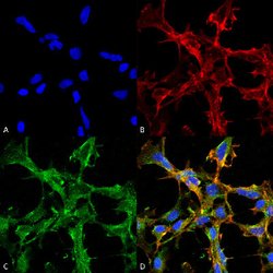 Citrulline Mouse, APC, Clone:2D3.1, Abnova 100 &mu;g | Buy Online | Abnova Corporation | Fisher Scientific