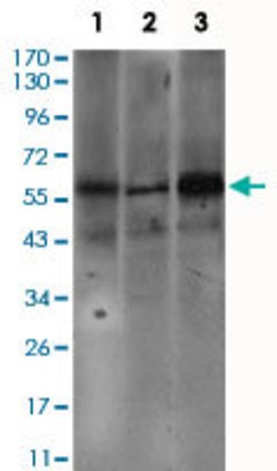FCER1A Mouse anti-Human, Clone:1F2A9, Abnova 100&mu;g:Antibodies, Monoclonal
