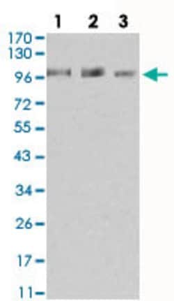AOF2 Mouse anti-Human, Clone:3F9D2, Abnova 100&mu;g:Antibodies, Monoclonal