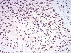 AOF2 Mouse anti-Human, Clone:3F9D2, Abnova 100&mu;g:Antibodies, Monoclonal