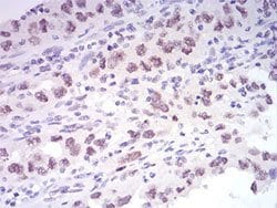 AOF2 Mouse anti-Human, Clone:3F9D2, Abnova 100&mu;g:Antibodies, Monoclonal