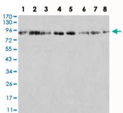 AOF2 Mouse anti-Human, Monkey, Clone:3F9A3, Abnova 100&mu;g:Antibodies,