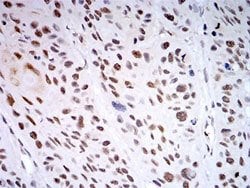 AOF2 Mouse anti-Human, Monkey, Clone:3F9A3, Abnova 100&mu;g:Antibodies,