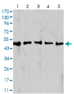 IDH1 Mouse anti-Human, Monkey, Mouse, Clone:7G8A1, Abnova 100&mu;g:Antibodies,