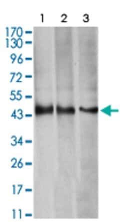 AURKA Mouse anti-Human, Clone:2D8A4, Abnova 100&mu;g:Antibodies, Monoclonal