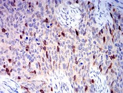 AURKA Mouse anti-Human, Clone:2D8A4, Abnova 100&mu;g:Antibodies, Monoclonal