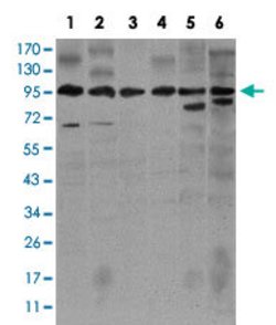 NOS2 Mouse anti-Human, Clone:400000, Abnova 100 &mu;g | Buy Online | Abnova | Fisher Scientific