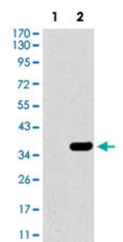 SLC27A5 Mouse anti-Human, Clone:4B11C10, Abnova 100&mu;g:Antibodies, Monoclonal