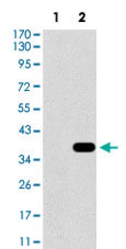 SLC27A5 Mouse anti-Human, Clone:9C4D1, Abnova 100&mu;g:Antibodies, Monoclonal