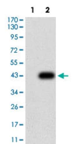 TFAP2C Mouse anti-Human, Clone:2F12A6, Abnova 100&mu;g:Antibodies, Monoclonal