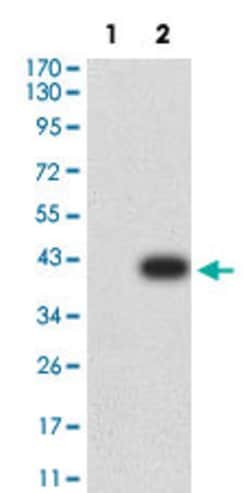 CIRBP Mouse anti-Human, Clone:6E12D5, Abnova 100&mu;g:Antibodies, Monoclonal