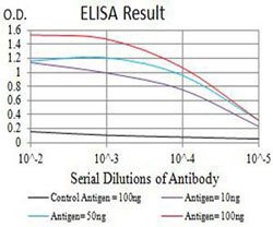 BCR Mouse anti-Human, Clone:1E11G12, Abnova 100&mu;g:Anticuerpos