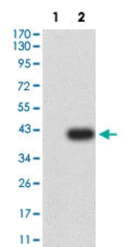 GRM6 Mouse anti-Human, Clone:4C11E12, Abnova 100&mu;g:Antibodies, Monoclonal