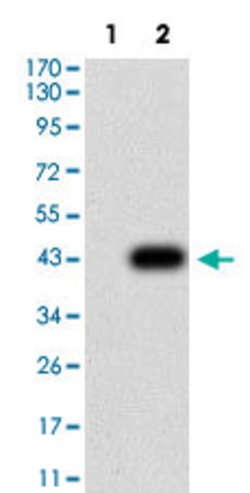 P2RY1 Mouse anti-Human, Clone:4G5D6, Abnova 100&mu;g:Antibodies, Monoclonal