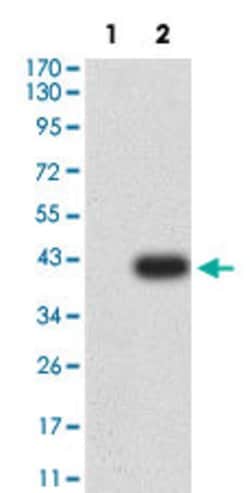 CCR3 Mouse anti-Human, Clone:8E9H10, Abnova 100&mu;g:Antibodies, Monoclonal