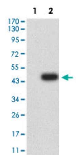 GRM2 Mouse anti-Human, Clone:6E4F6, Abnova 100&mu;g:Antibodies, Monoclonal
