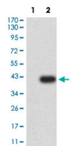 CCR7 Mouse anti-Human, Clone:4B7B8, Abnova 100μg:Antibodies, Monoclonal