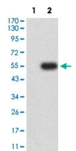 IL2RB Mouse anti-Human, Clone:1G11H3, Abnova 100&mu;g:Antibodies, Monoclonal