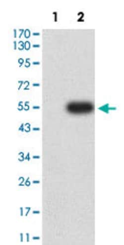 BTN3A1 Mouse anti-Human, Clone:4E1B9, Abnova 100 &mu;g | Buy Online | Abnova | Fisher Scientific