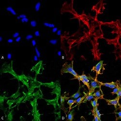 Citrulline Mouse, ATTO 488, Clone: 2D3.1, Abnova 100 &mu;g | Buy Online | Abnova Corporation | Fisher Scientific