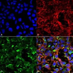 Dityrosine Mouse anti-Human, PerCP, Clone: 7D4, Abnova 100 &mu;g; PerCP:Antibodies,