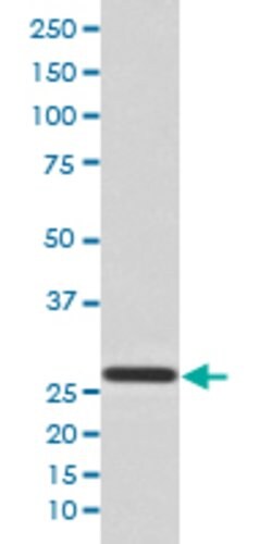 YWHAQ Rabbit anti-Human, Mouse, Rat, Unconjugated, Clone: HHF-25 , Abnova