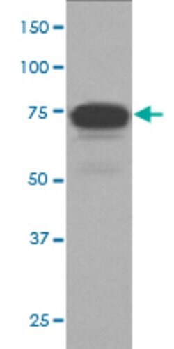 TPBG Rabbit anti-Human, Mouse, Rat, Unconjugated, Clone: CDA-20, Abnova