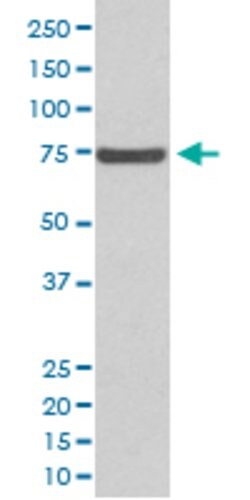 ABCG2 Rabbit anti-Human, Unconjugated, Clone: AODG-1 , Abnova 100 &mu;g;