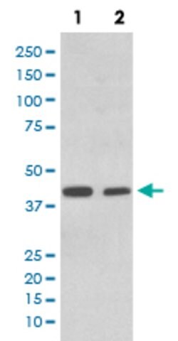 ACADM Rabbit anti-Human, Mouse, Rat, Unconjugated, Clone: COE-1 , Abnova