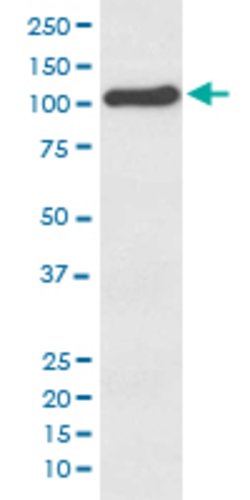 ACE2 Rabbit anti-Human, Mouse, Rat, Unconjugated, Clone: GEE-1 , Abnova