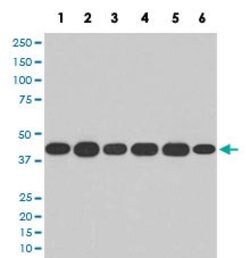 ACTA1 Rabbit anti-Human, Mouse, Rat, Unconjugated, Clone: BE-1, Abnova
